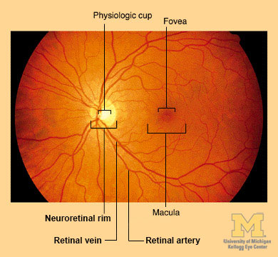 Retina & Optic Nerve Through Ophthalmoscope