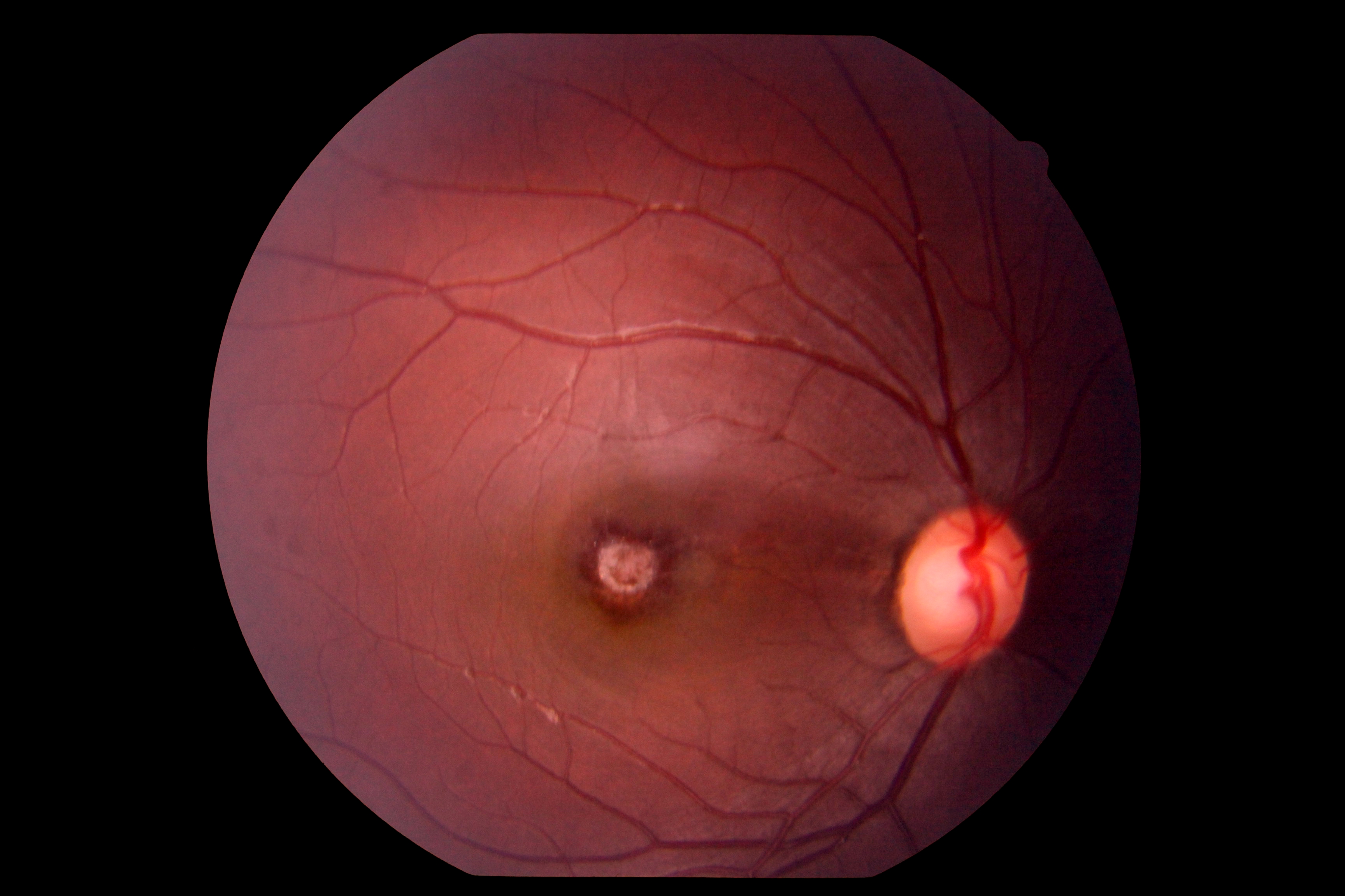 Fundus